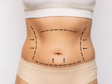 plastic_surgery_mexicali-09