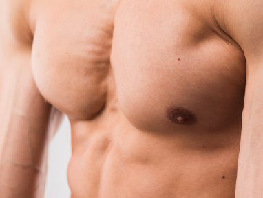 plastic_surgery_mexicali-15